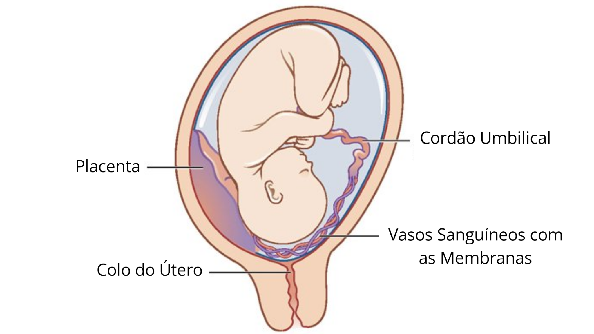 Cesárea Quando Realmente é Indicação 1024